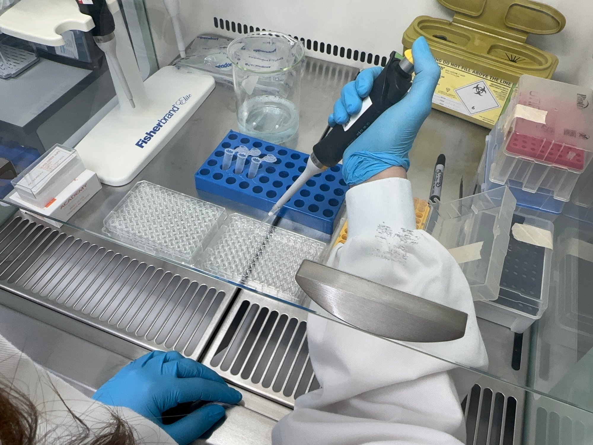 Human Blood Processing